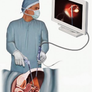Hysteroscopic surgery2
