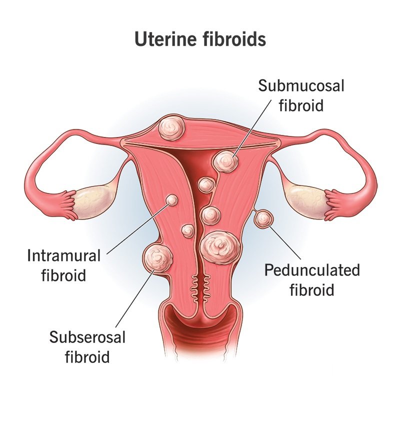 best laparoscopic gynae surgeon in kolkata